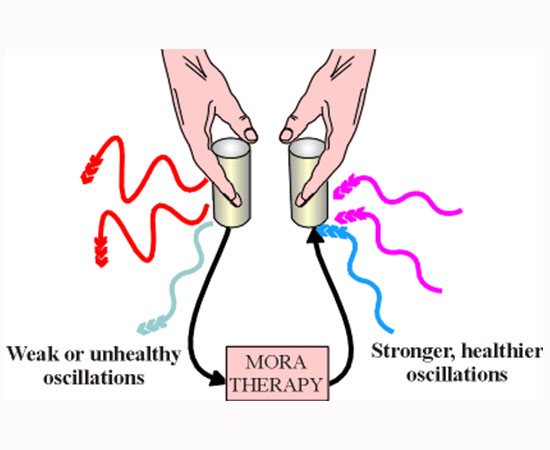 Bioresonance (MORA) therapy