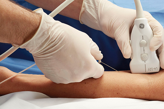 ULTRASOUND DIAGNOSTIC SCREENING AND ULTRASOUND-GUIDED INJECTIONS