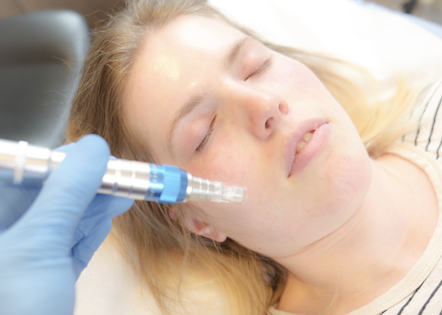 prp microneedling at new health medical center